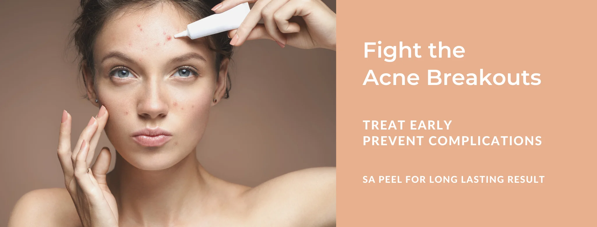 acne treatment in delhi