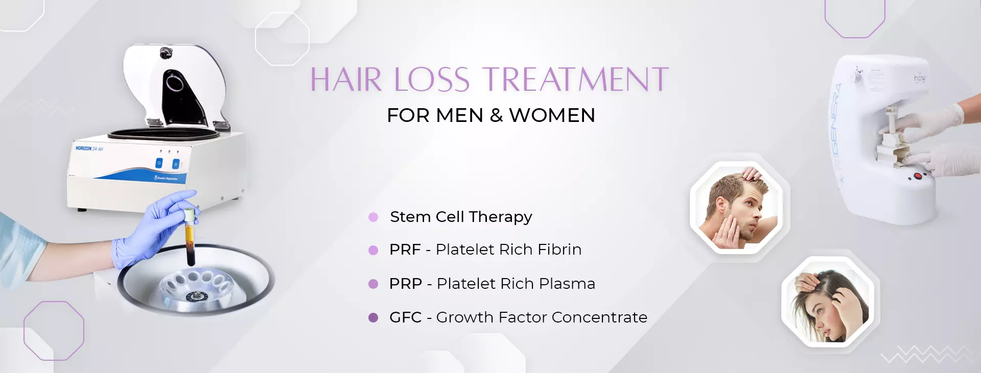 Best Hair Loss Treatment in Delhi  Gupta MBBS, MD - SKINOS