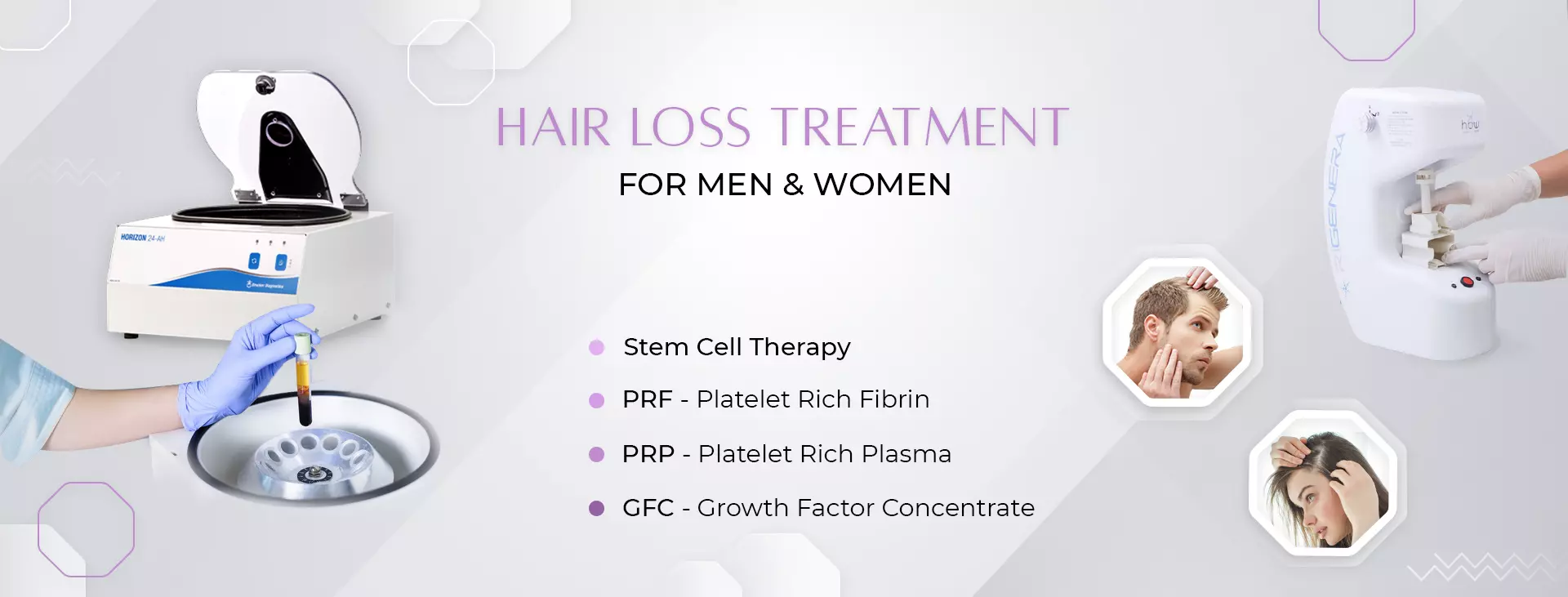 GFC Treatment In Delhi  Hair Loss Treatment In Delhi  Uks Derma