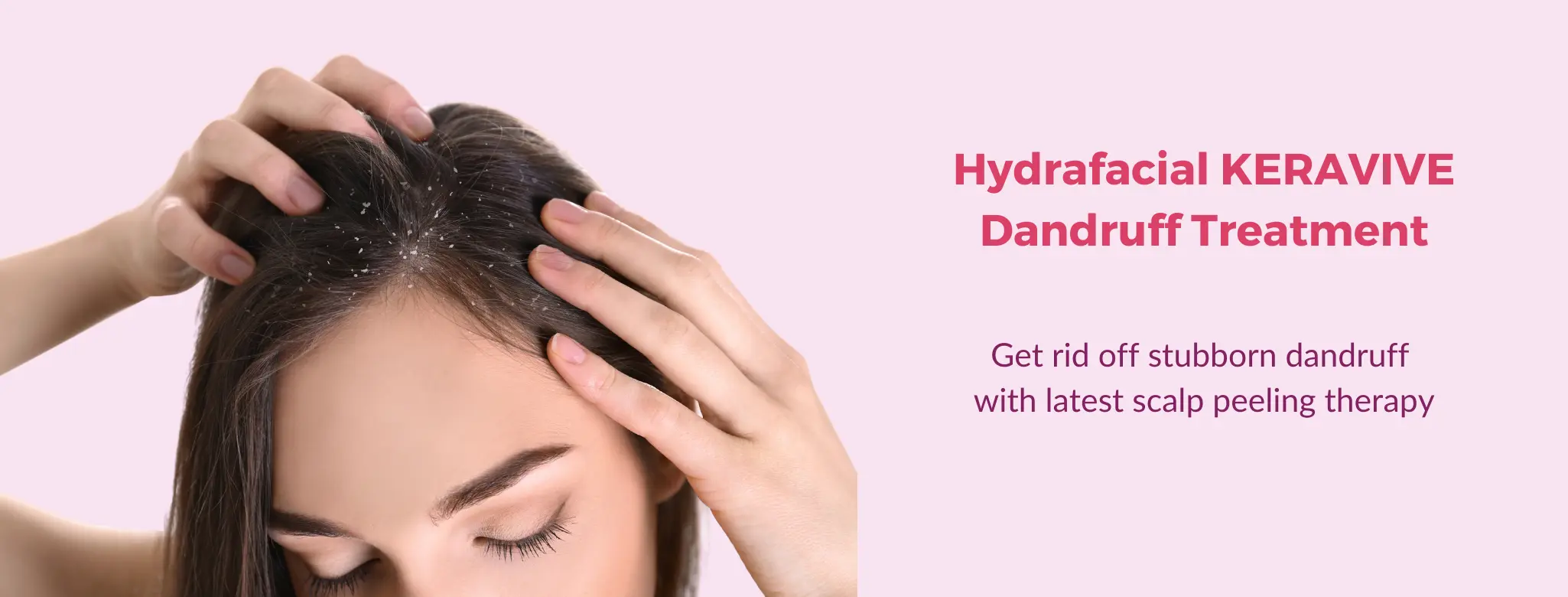 dandruff treatment in delhi