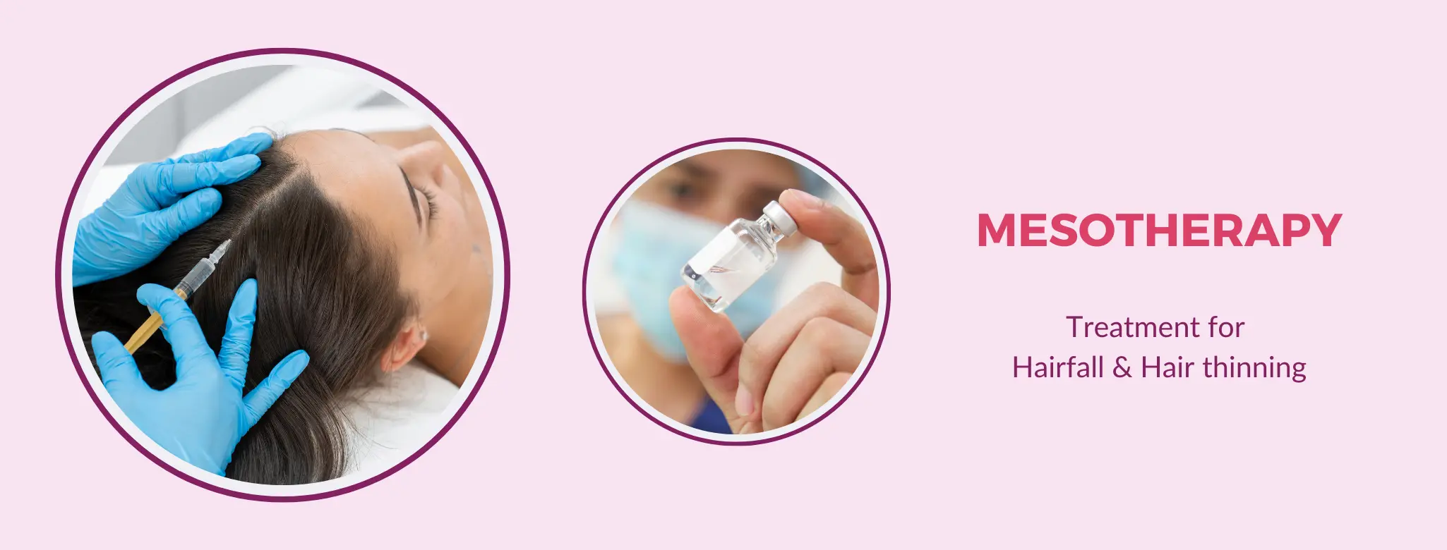 mesotherapy treatment in delhi