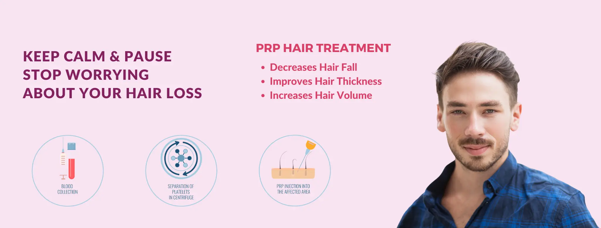 prp treatment in delhi