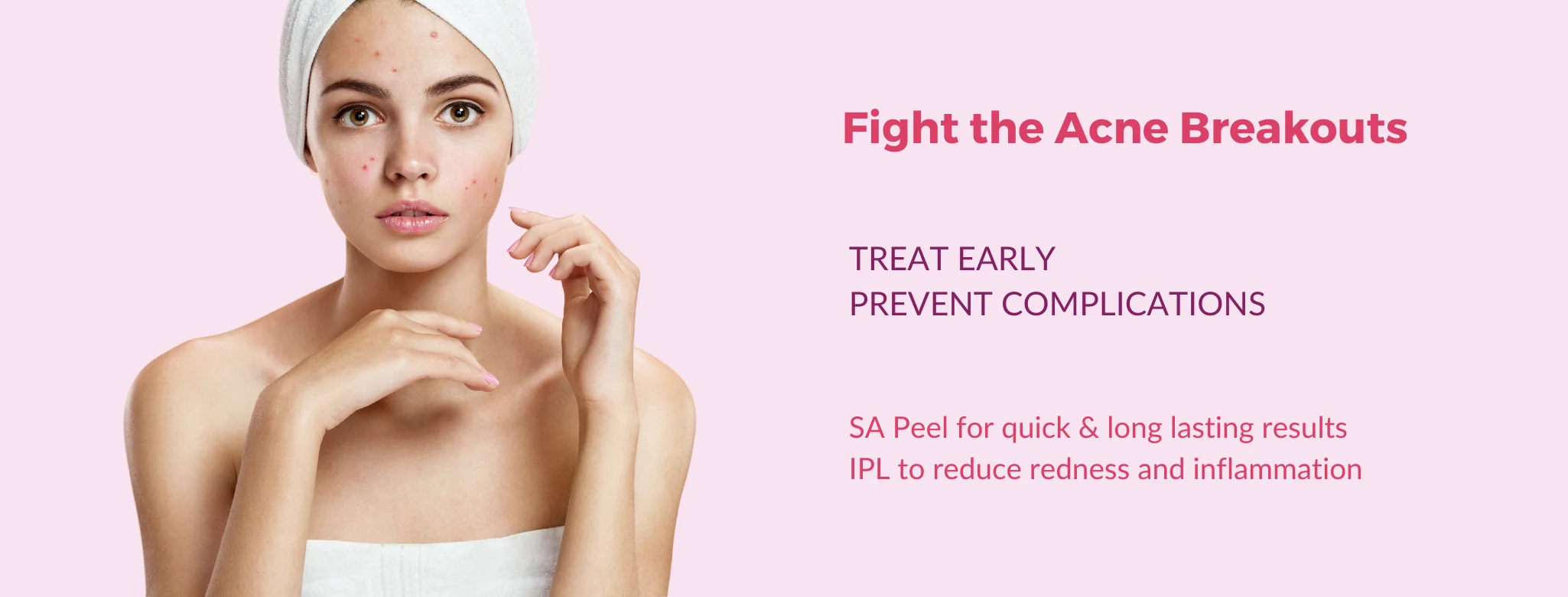 acne treatment in delhi