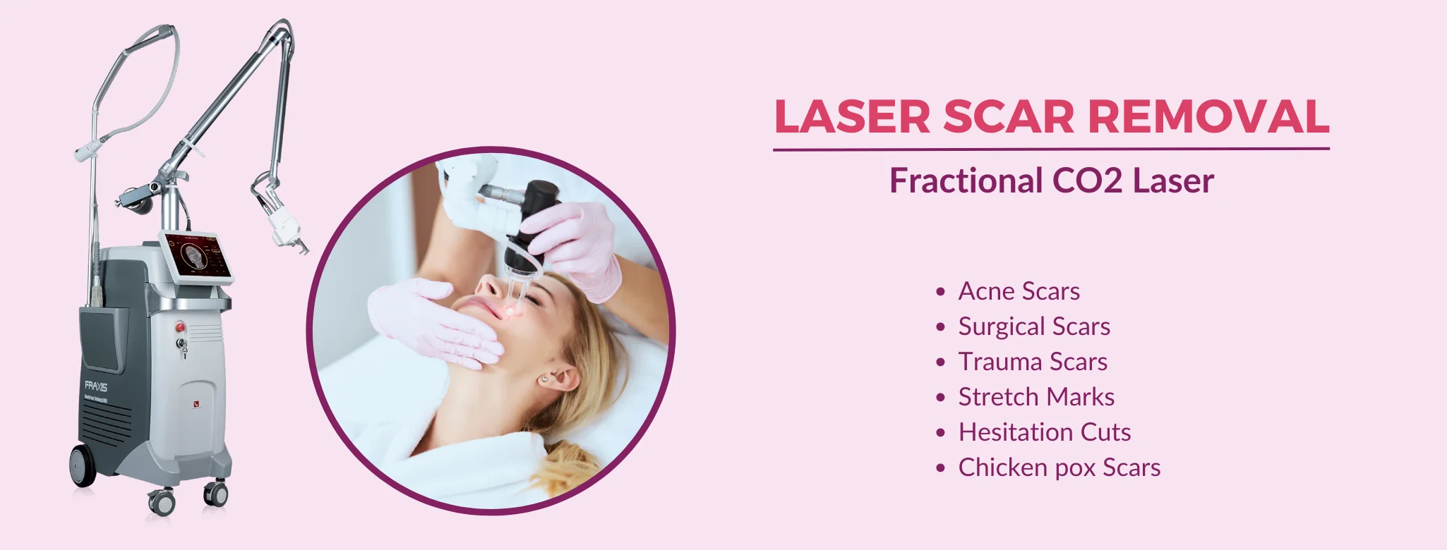 laser scar removal in delhi