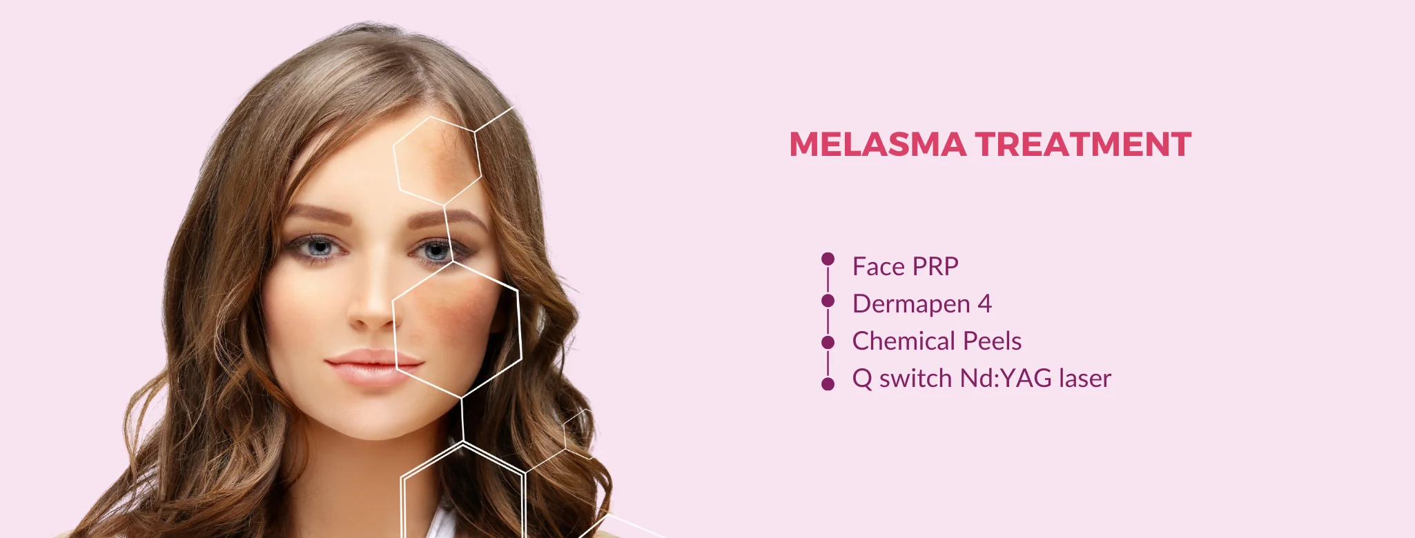 face pigmentation treatment in delhi