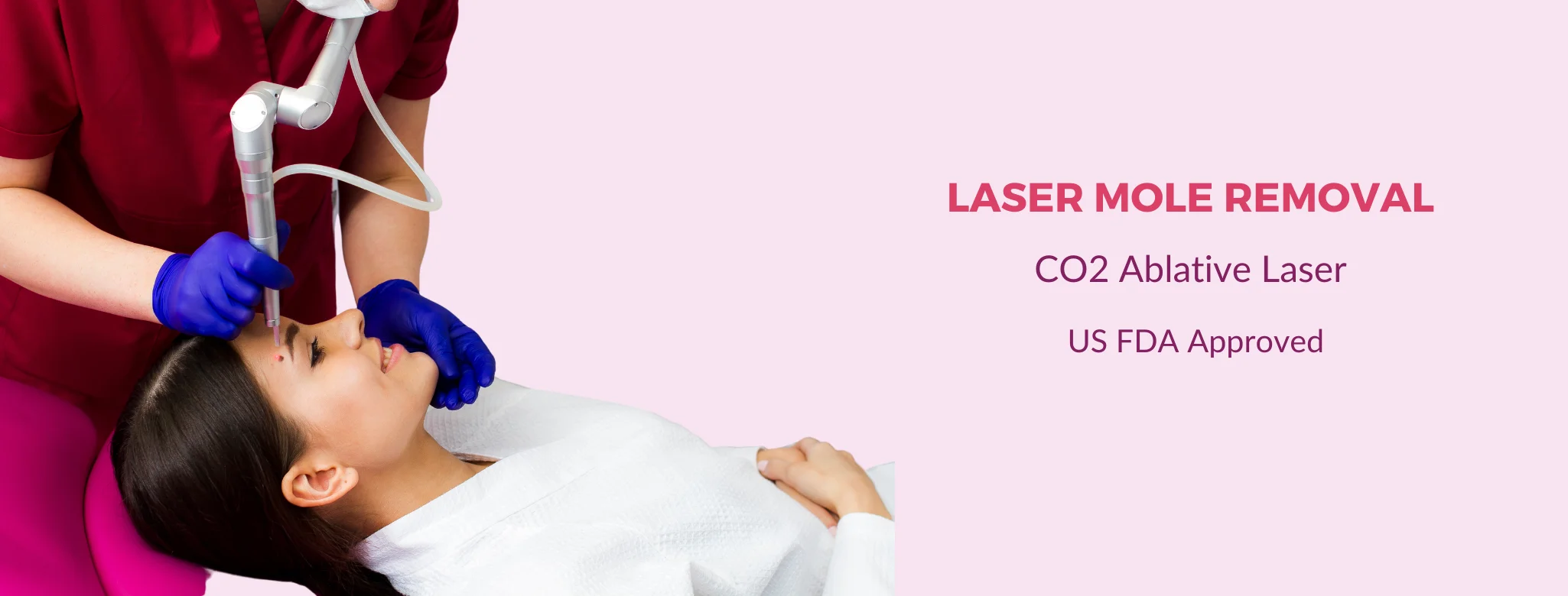 laser mole removal in delhi