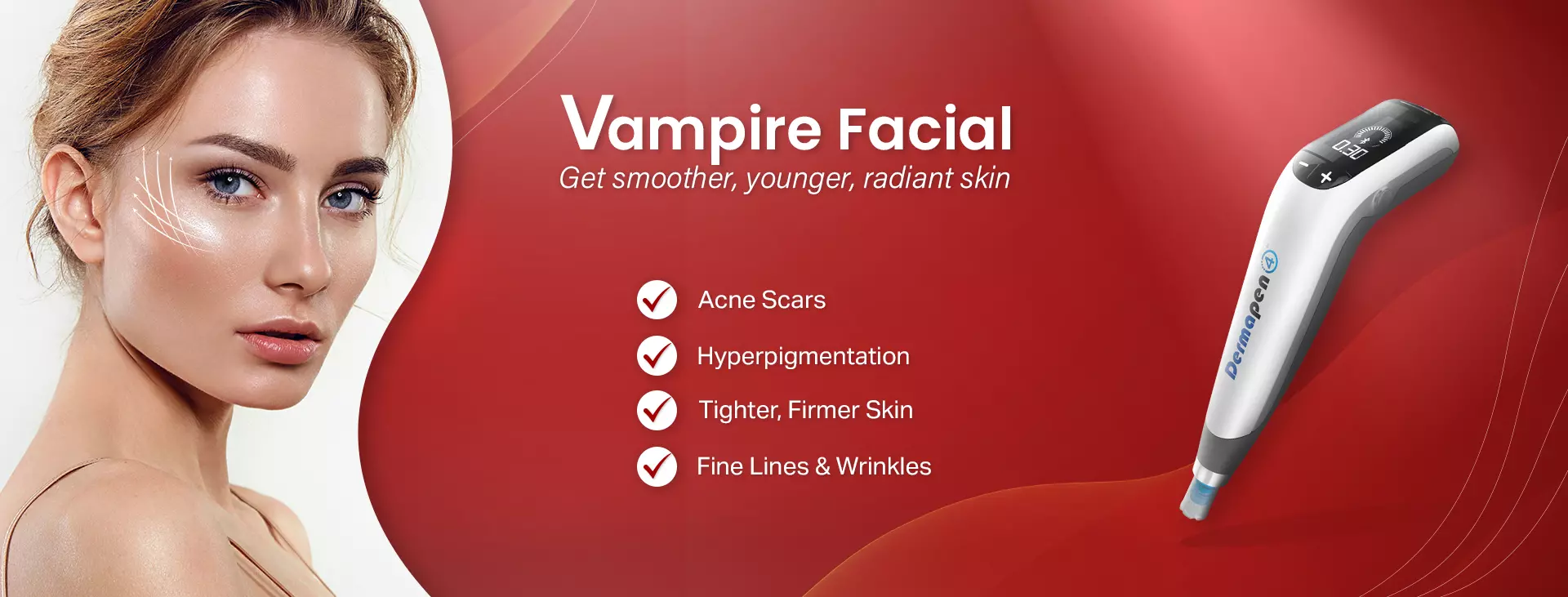 vampire facial in delhi